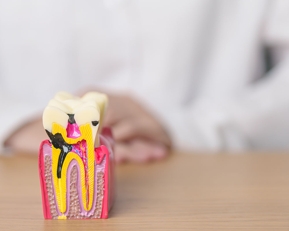 Are Root Canals Dangerous?