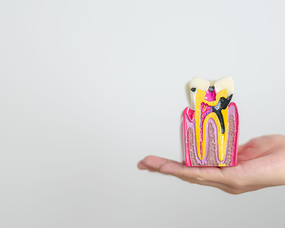 The Link Between Ailments and Root Canals