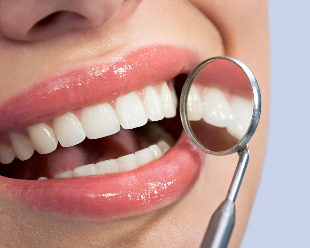How to Straighten Teeth Without Braces: Natural, Comfortable Solutions 