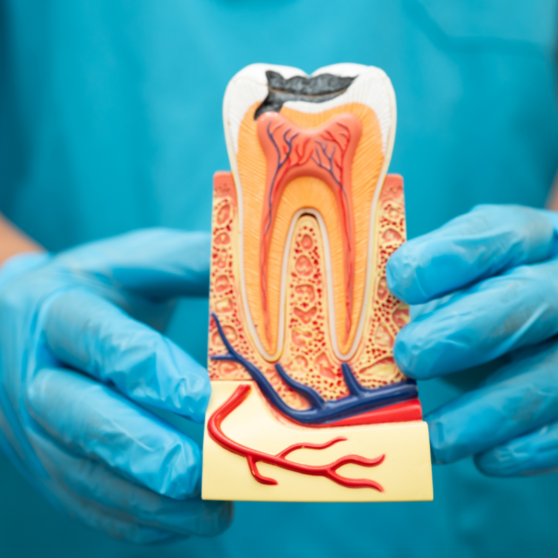 Are Root Canal Poisonous? Risks, Alternatives, Care