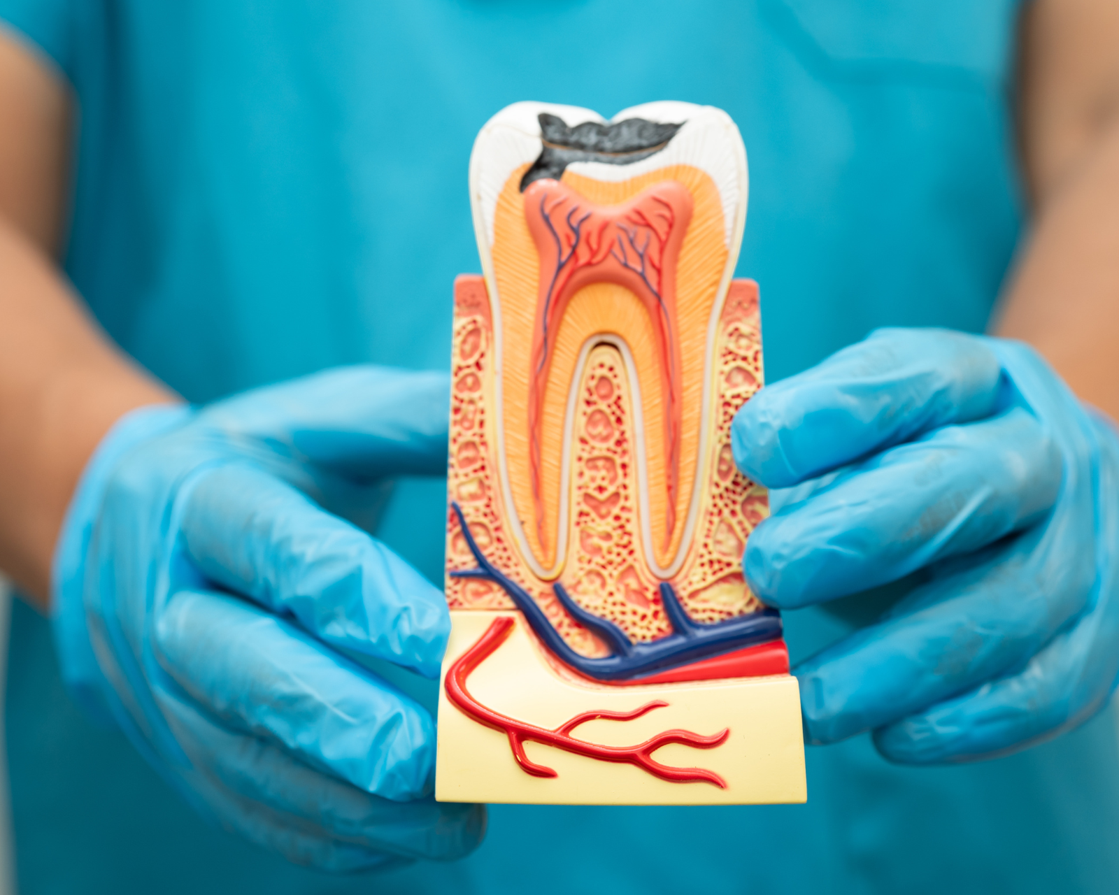 Are Root Canal Poisonous? Risks, Alternatives, Care